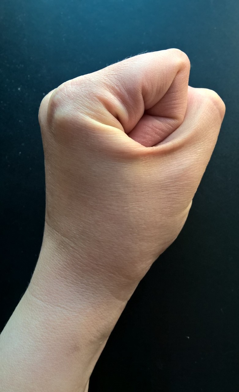 WP_20160407_08_47_52_Pro